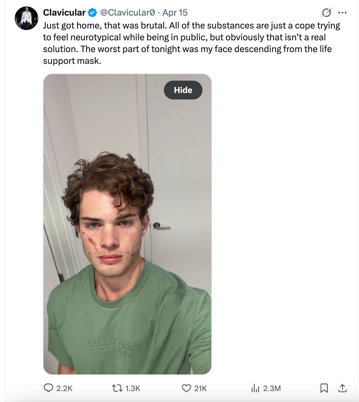 Clavicular Twitter post.